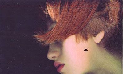 脸上的痣能随便点掉吗