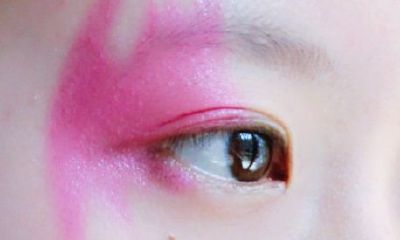 红色胎记的位置与命运，胎记长在哪里最好？