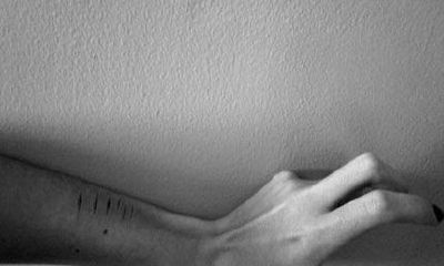 胎记的位置看个人的人生命运