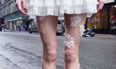 身上的痣越来越多好不好