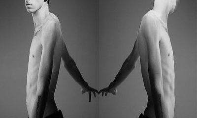 痣与斑在面相中的讲究