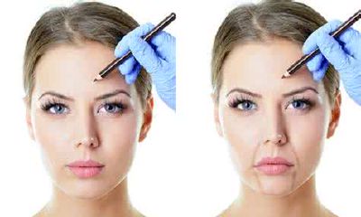 法令纹过长绕嘴面相（女性法令纹吉凶面相图解）