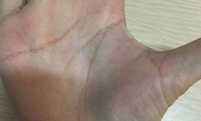 手相寿命短一定活不长吗（手相说短命就一定会早死吗）