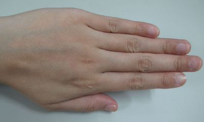 手相有鱼形纹好不好（手相有口字纹好不好）