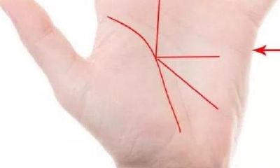 胃癌症手相图（癌症患者手相特征）