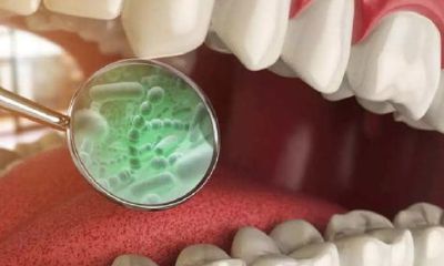 梦见牙齿掉是怎么回事周公解梦（梦见自己掉牙齿周公解梦）