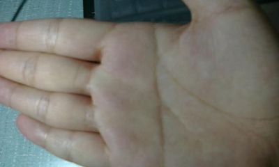 手相有一条横线贯穿（手相月丘有一条横线）