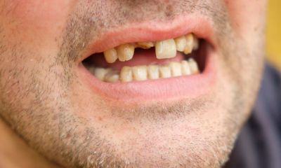 梦见牙齿掉了一颗（梦见自己一颗牙掉了是什么意思）