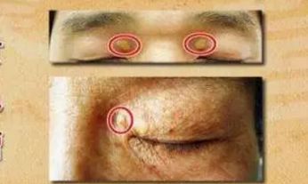 耳垂有一道折痕面相（什么日柱容易做官）