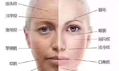 破颧纹面相的人怎么样（男人脸上有泪沟面相）