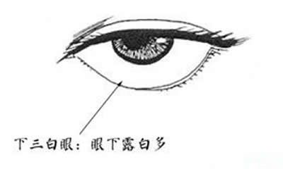 下三白的人面相分析（男人下三白眼面相分析）