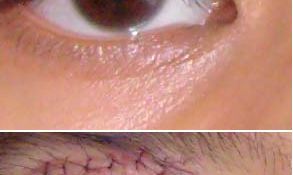 男的上眼皮下垂面相（面相眼角下垂的男人）