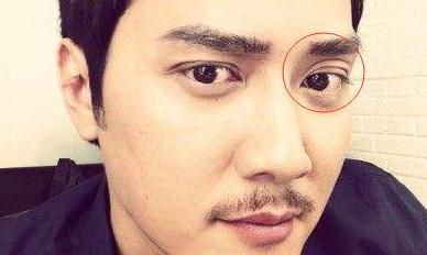 男生三层眼皮面相（右边三眼皮面相）