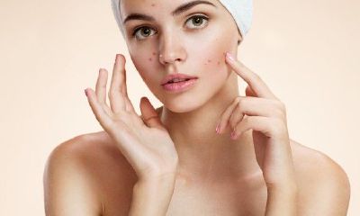 女人脸上痘坑面相（人中有痘坑对面相有影响吗）