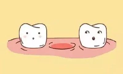 缺牙影响财运（门牙缺失影响财运吗）