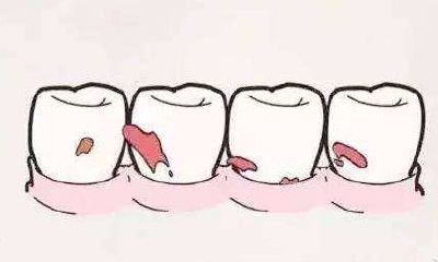 女人梦见自己掉大牙预言（女人梦见自己掉牙）