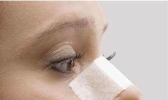 整鼻子会改变财运吗（鼻子整形会改变风水吗）