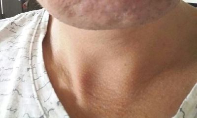 嘴唇轮廓不清晰男生面相（抬头纹面相图解男）