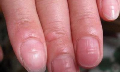 指甲形状看手相（怎样看手相图解）