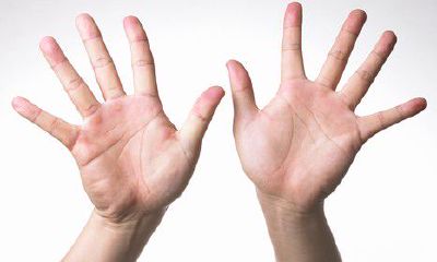 女人左手心痒测吉凶（女人左手痒预示着吉凶）