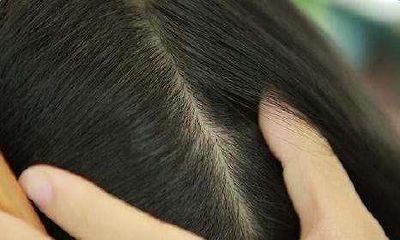 发际线不齐女面相（发际线不齐面相）