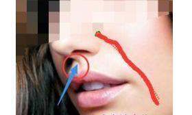 女人法令纹分叉面相（法令纹分叉两条的面相）