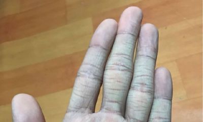 手相夫子眼及藏宝纹（手相中的钻石纹是怎样的）