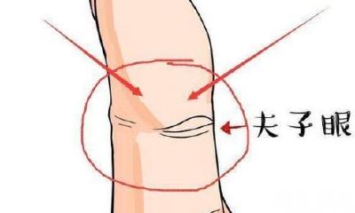 女生手相夫子眼（夫子眼非常出名的手相）