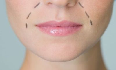 下巴八字纹面相分析（女人双雀纹面相长寿吗）