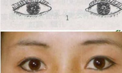 眼睛面相分类图（左眼小右眼大的男人面相）