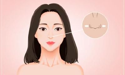 详解左鼻孔下方痣的意义及影响：左侧鼻旁痣的美学与命相说法探究