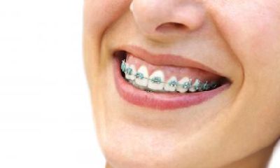 女性小指上的痣意味着什么？小指痣的解读与分析