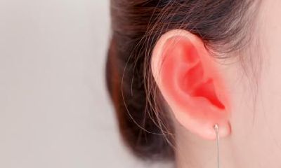 探讨耳廓痣对女性命运的影响：详解耳朵上的痣是否为好兆头