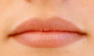 女人右眼皮下长有痣，这种状况好不好？以及女人痣长在哪些部位有助于其财运和成功？